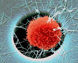 Hematopoietic stem cell